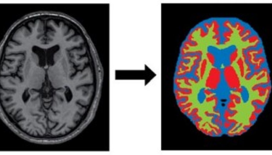 Medische Beeldbewerking met behulp van Artificial Intelligence